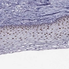 Immunohistochemical staining of human cervix, uterine shows strong nuclear positivity in squamous epithelial cells.