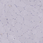 Immunohistochemical staining of human skeletal muscle shows no positivity in myocytes as expected.