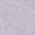 Immunohistochemical staining of human skeletal muscle shows no positivity in myocytes as expected.
