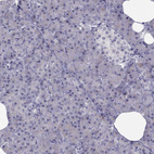 Anti-TRPS1 Antibody