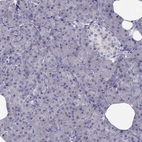 Immunohistochemical staining of human pancreas shows no positivity in exocrine glandular cells as expected.