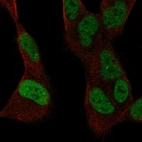 Immunofluorescent staining of human cell line SH-SY5Y shows localization to nucleoplasm.