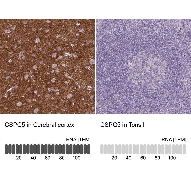 Anti-CSPG5 Antibody