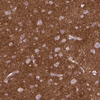 Immunohistochemical staining of human cerebral cortex shows strong positivity in cytoplasm granular in neuropil.