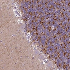 Immunohistochemical staining of human cerebellum shows strong cytoplasmic positivity in cells in granular layer.