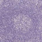 Anti-CSPG5 Antibody
