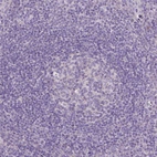 Immunohistochemical staining of human tonsil shows no positivity in non-germinal center cells as expected.