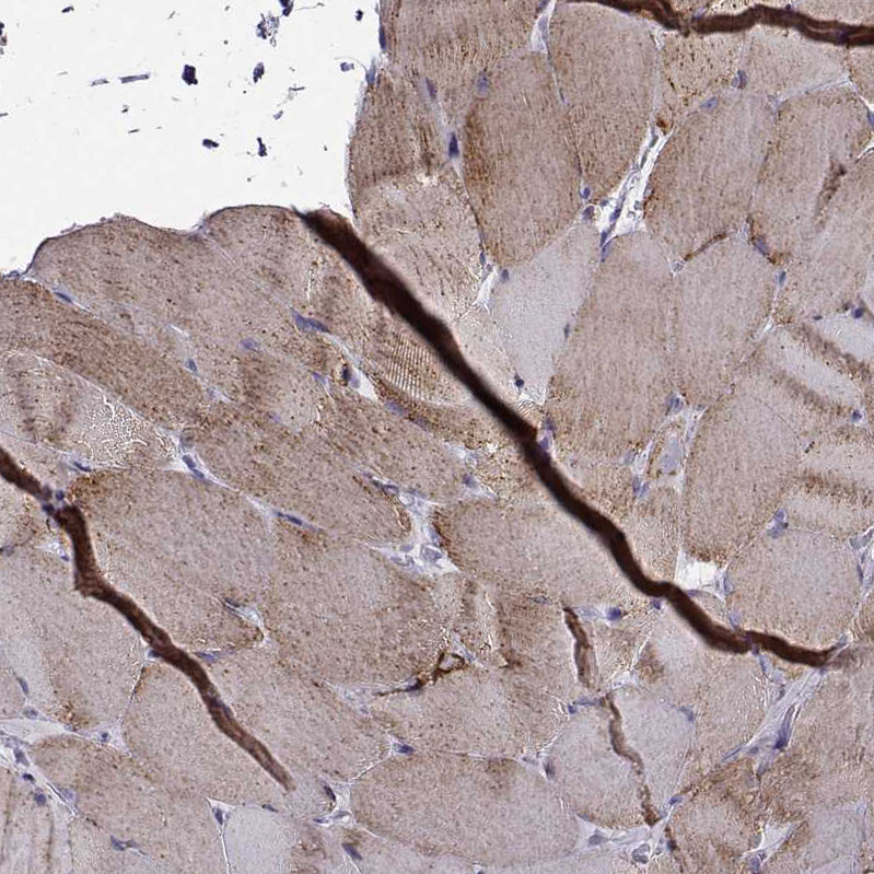 Anti-NECAB3 Antibody