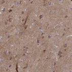 Immunohistochemical staining of human cerebral cortex shows moderate cytoplasmic granular positivity in neurons.