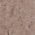 Immunohistochemical staining of human cerebral cortex shows moderate cytoplasmic granular positivity in neurons.