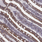 Immunohistochemical staining of human gastrointestinal shows moderate cytoplasmic granular positivity in glandular cells.