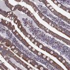 Immunohistochemical staining of human gastrointestinal shows moderate cytoplasmic granular positivity in glandular cells.