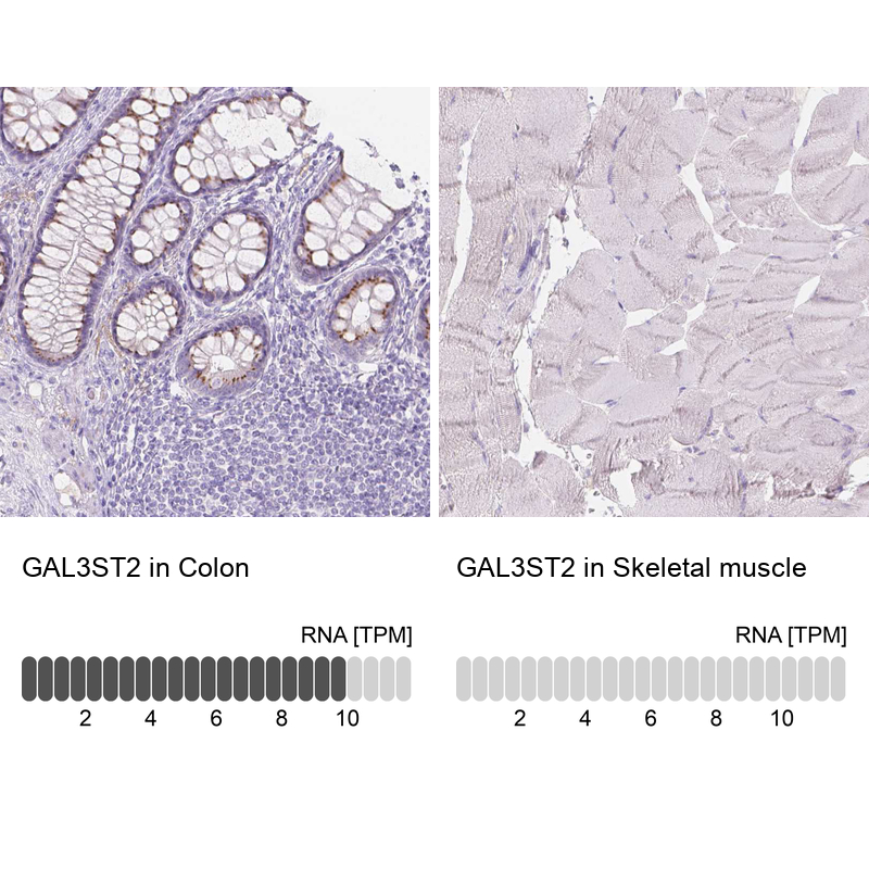 Anti-GAL3ST2 Antibody