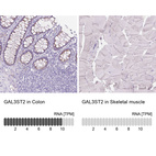 Anti-GAL3ST2 Antibody