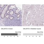 Anti-GAL3ST2 Antibody