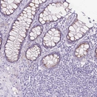 Immunohistochemical staining of human colon shows strong cytoplasmic granular positivity in enterocytes.