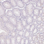 Immunohistochemical staining of human stomach shows negative cytoplasmic positivity in glandular cells as expected.