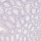 Immunohistochemical staining of human stomach shows negative cytoplasmic positivity in glandular cells as expected.