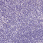 Immunohistochemical staining of human tonsil shows negative cytoplasmic positivity in non-germinal center cells as expected.