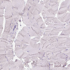 Immunohistochemical staining of human skeletal muscle shows negative cytoplasmic positivity in myocytes as expected.