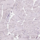 Immunohistochemical staining of human skeletal muscle shows negative cytoplasmic positivity in myocytes as expected.