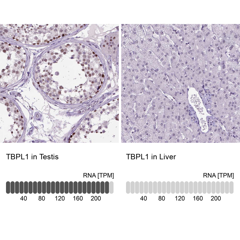 Anti-TBPL1 Antibody