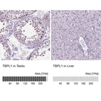 Anti-TBPL1 Antibody