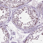 Immunohistochemical staining of human testis shows high expression.