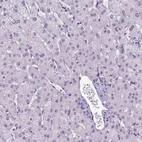 Immunohistochemical staining of human liver shows low expression as expected.