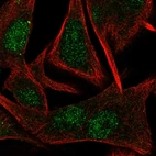 Immunofluorescent staining of human cell line SK-MEL-30 shows localization to nucleus & nucleoli.