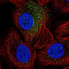 Anti-SORCS2 Antibody