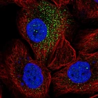 Anti-SORCS2 Antibody