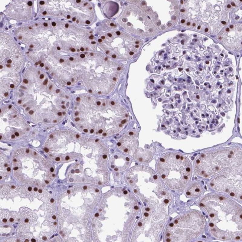 Anti-POLE4 Antibody