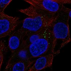 Immunofluorescent staining of human cell line Hep-G2 shows localization to vesicles.