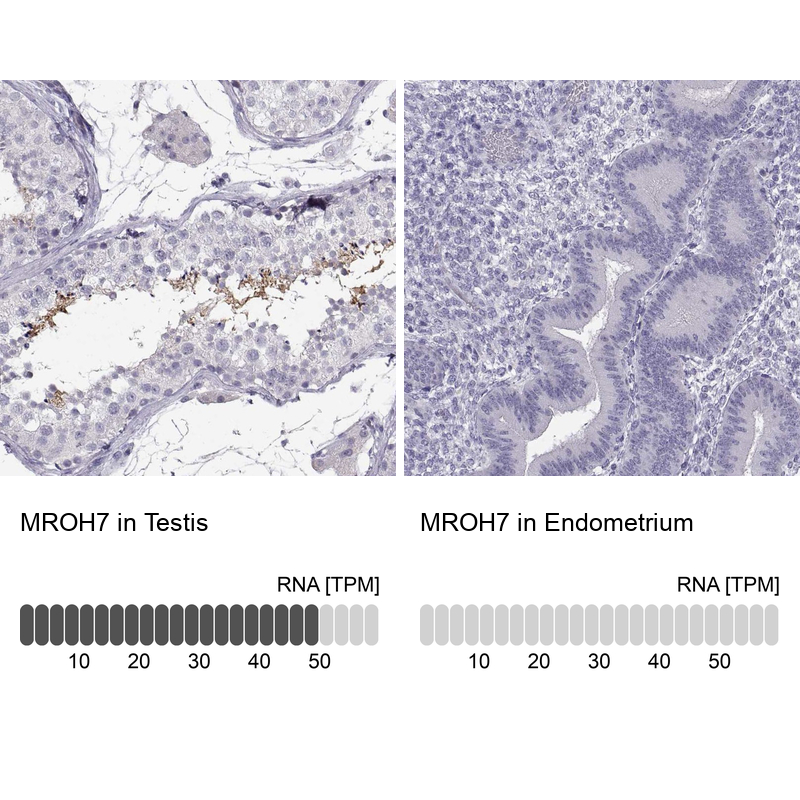 Anti-MROH7 Antibody