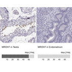 Anti-MROH7 Antibody