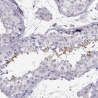 Immunohistochemical staining of human testis shows high expression.