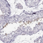 Immunohistochemical staining of human testis shows high expression.