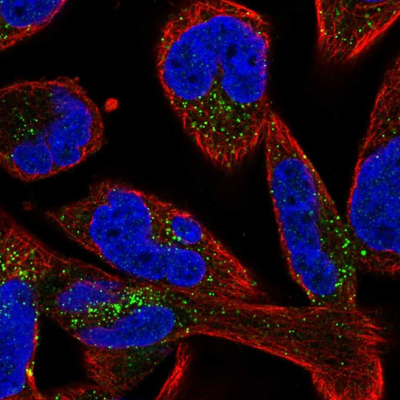 Anti-SMIM17 Antibody