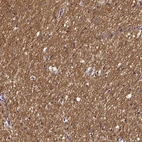 Immunohistochemical staining of human cerebral cortex shows high expression.