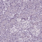 Immunohistochemical staining of human pancreas shows low expression as expected.