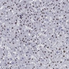 Anti-CYB561D2 Antibody