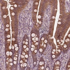 Anti-FAM234A Antibody