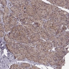 Immunohistochemical staining of human pancreas shows low expression as expected.