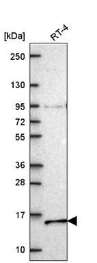 Western blot analysis in human cell line RT-4.