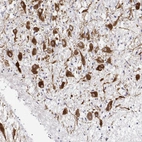 Immunohistochemical staining of human hypothalamus shows strong cytoplasmic positivity in neurons in paraventricular nucleus.
