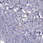 Immunohistochemical staining of human ovary shows moderate cytoplasmic positivity in oocytes.
