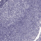 Immunohistochemical staining of human lymphoid tissues shows no positivity in lymphoid cells as expected.