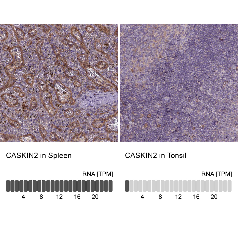 Anti-CASKIN2 Antibody