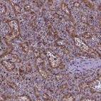Immunohistochemical staining of human spleen shows high expression.